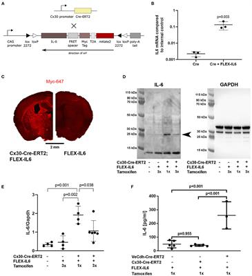 Paracrine Interleukin 6 Induces Cerebral Remodeling at Early Stages After Unilateral Common Carotid Artery Occlusion in Mice